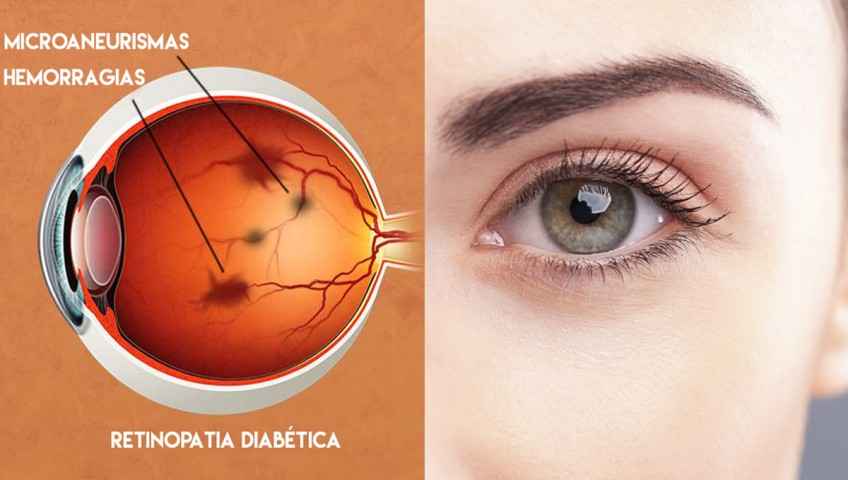 Image Title My Image